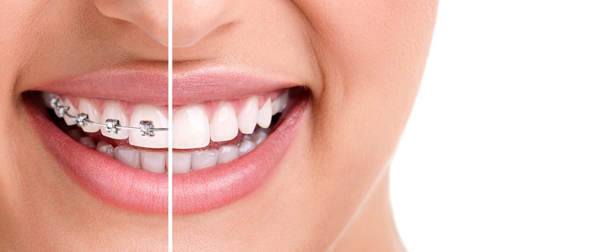 studio dentistico clinica feltre ortodonzia