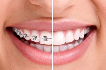 Orthodontics